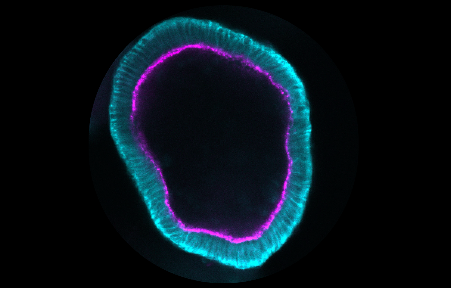 Organoid model grown from patient biopsy tissue