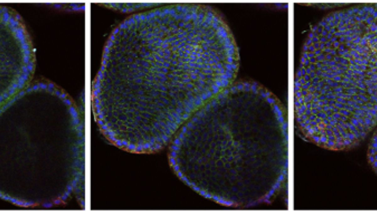 Organoid z-stack